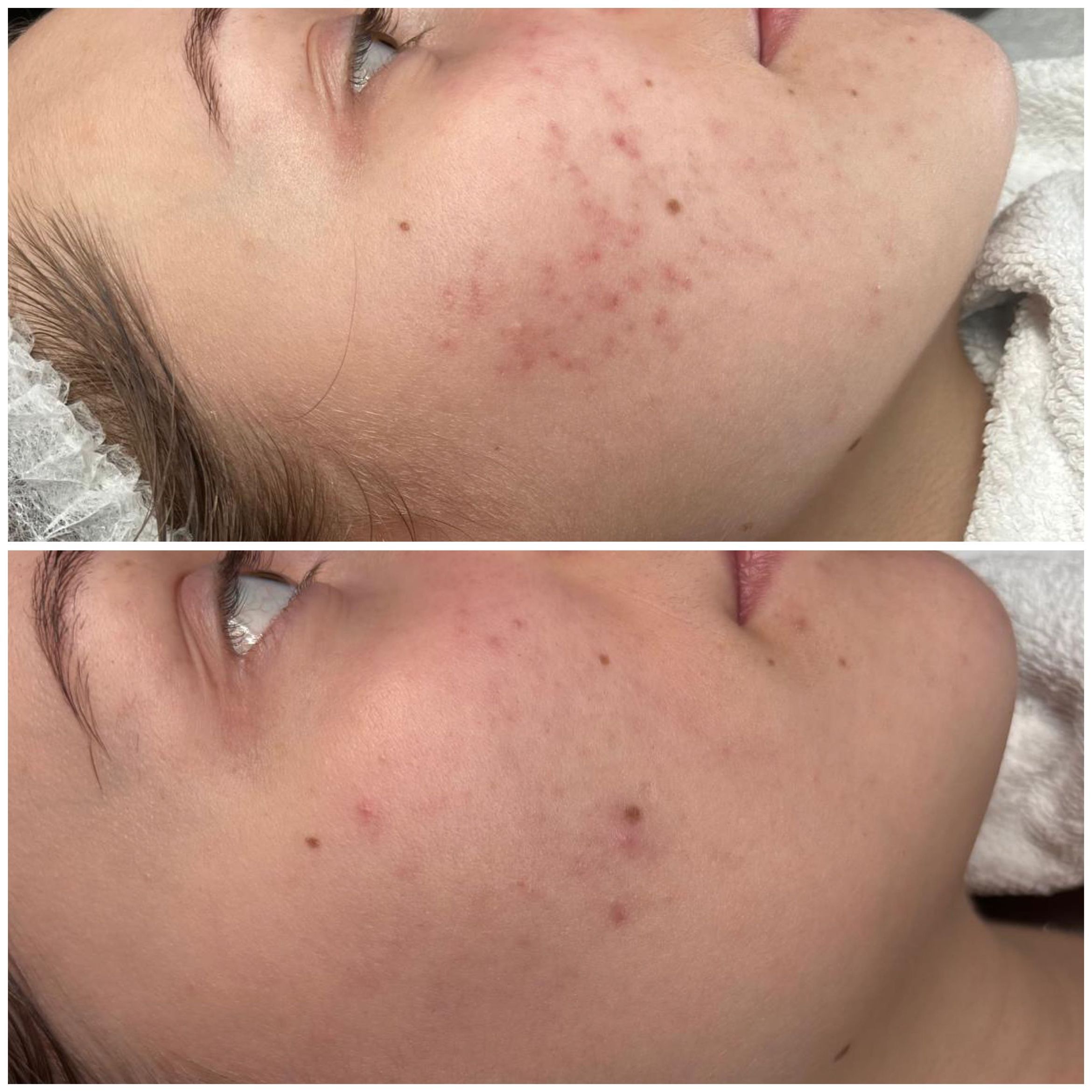 Efekty zabiegów Marsi Beauty przed i po