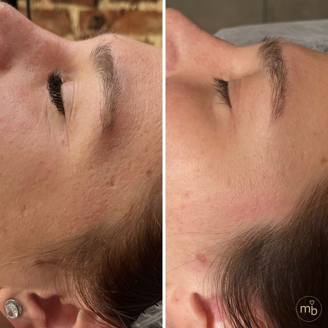 Efekty kosmetologii estetycznej Marsi Beauty